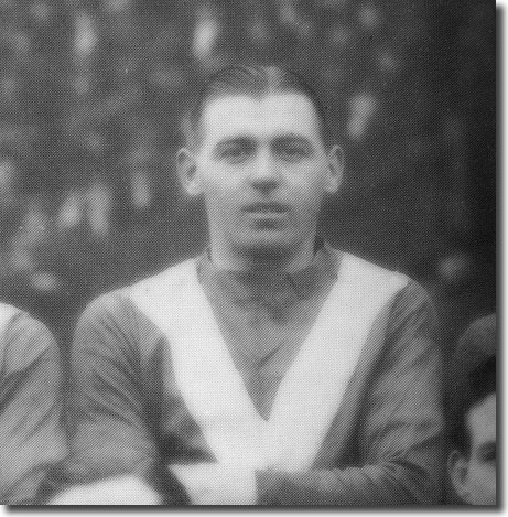 The unfortunate City captain Bob Hewison, who suffered a leg fracture in the first half